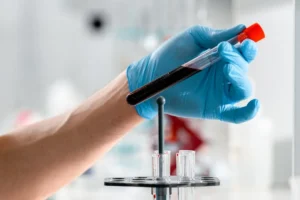 Blood purification with activated carbon adsorption